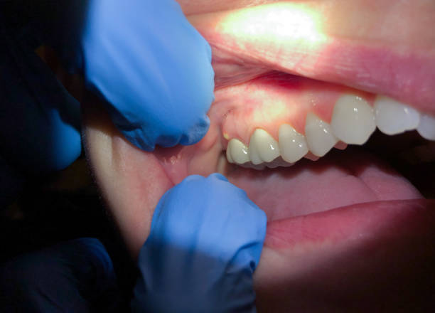 Best Walk-In Emergency Dental Services in West Liberty, KY