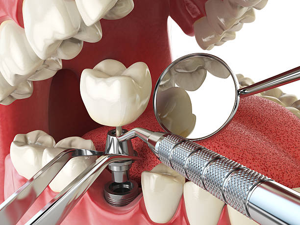 Best Emergency Root Canal Therapy in West Liberty, KY